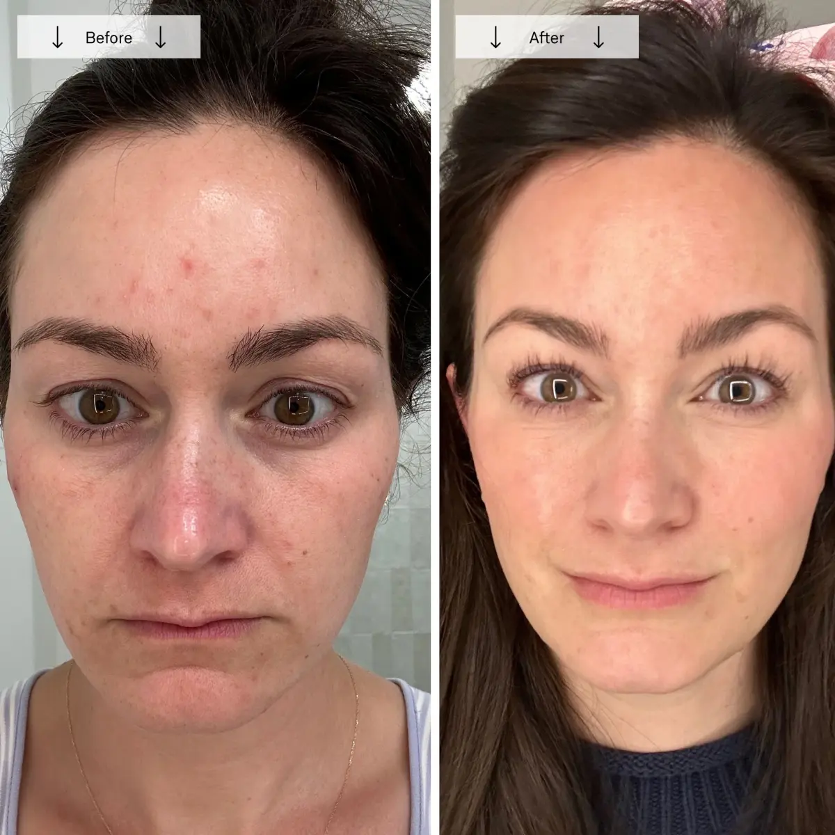 Customer before and after photo shown on the Omnilux Contour Face product page