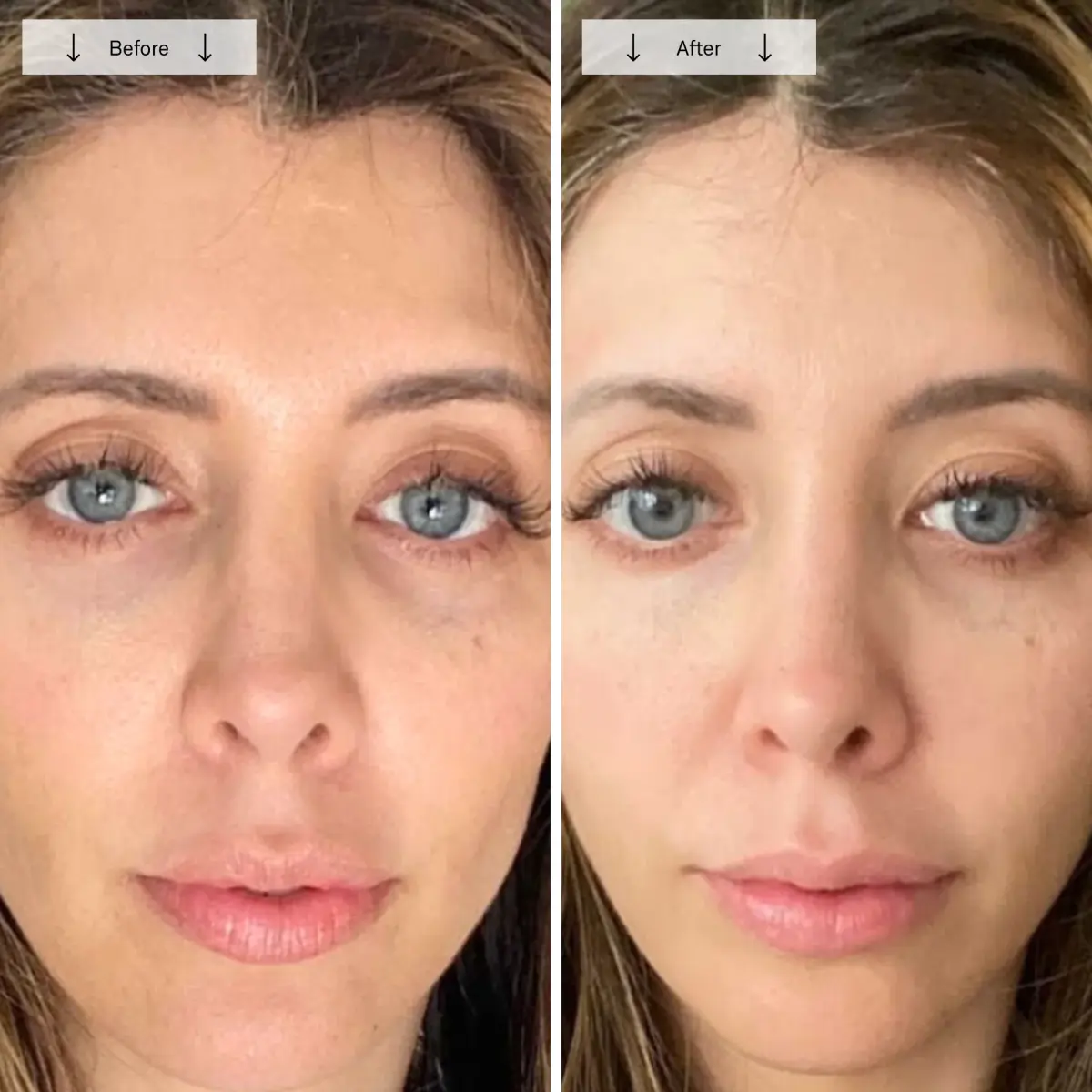 Second customer before and after photo shown on the Omnilux Contour Face product page