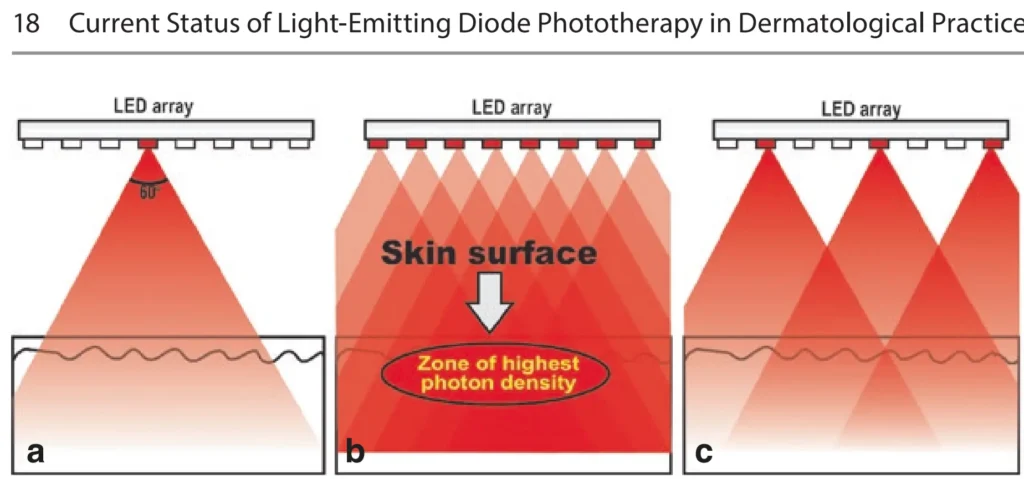 Led mask coverage importance number of leds clinical study