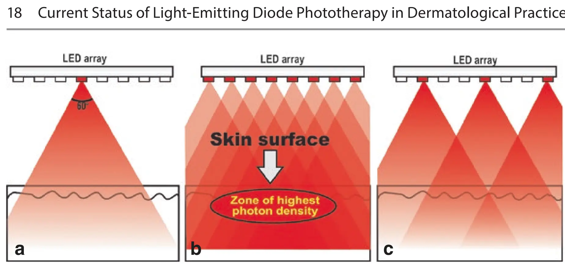 Led mask coverage importance number of leds clinical study
