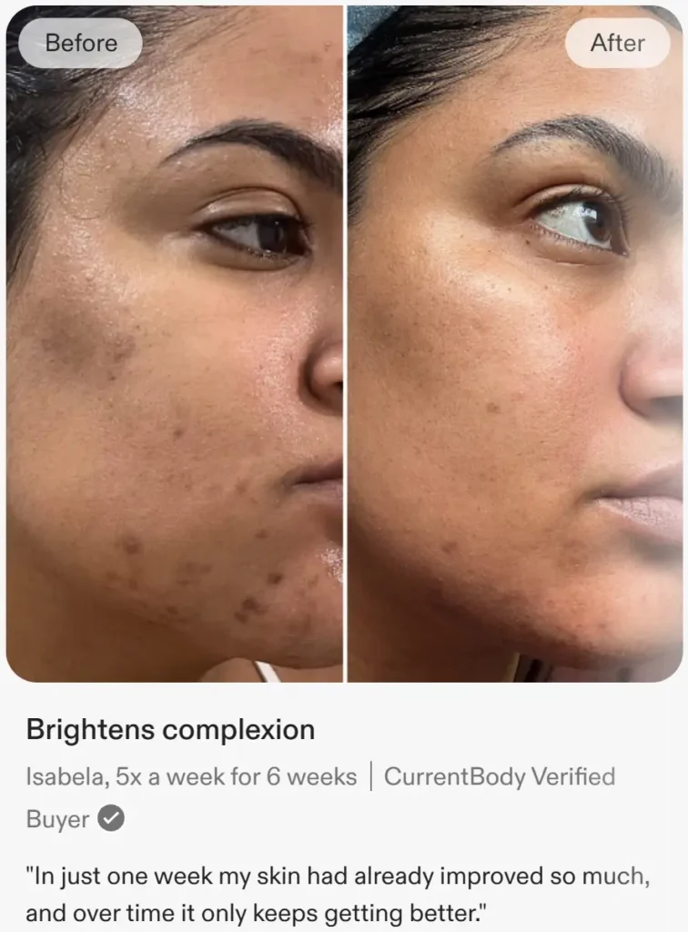 Customer before and after photograph published by CurrentBody, showing complexion and blemishes