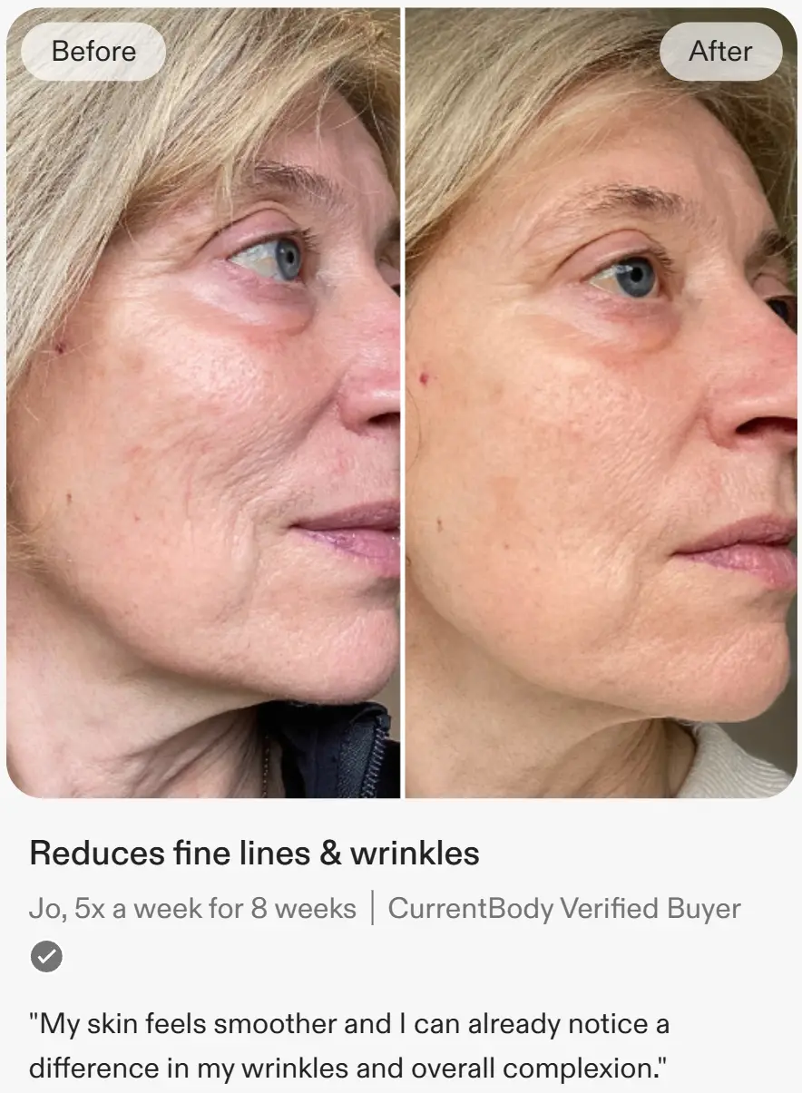 Before after fine lines currentbody led mask